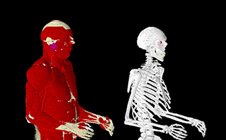 VariPose-Biologische-Mesh-Repositionierung