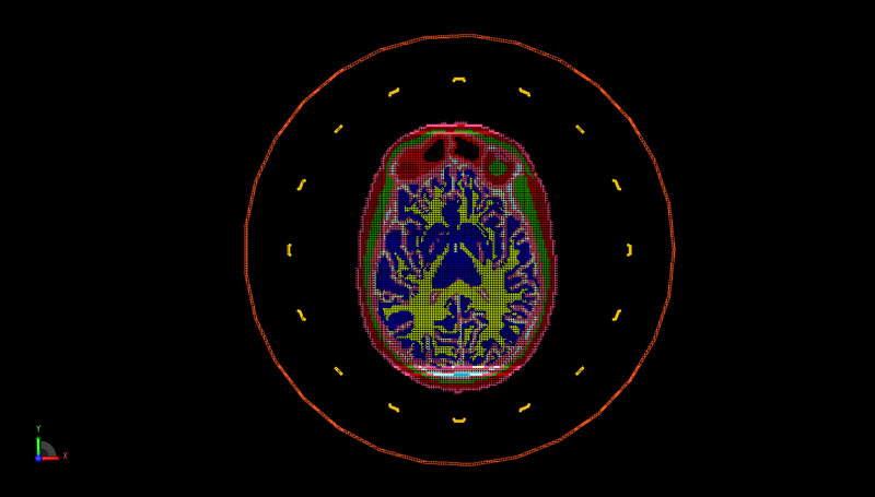 Abbildung 6: PrOGrid-Netzdarstellung der axialen Ebene des Kopfes und der Spulengeometrie.