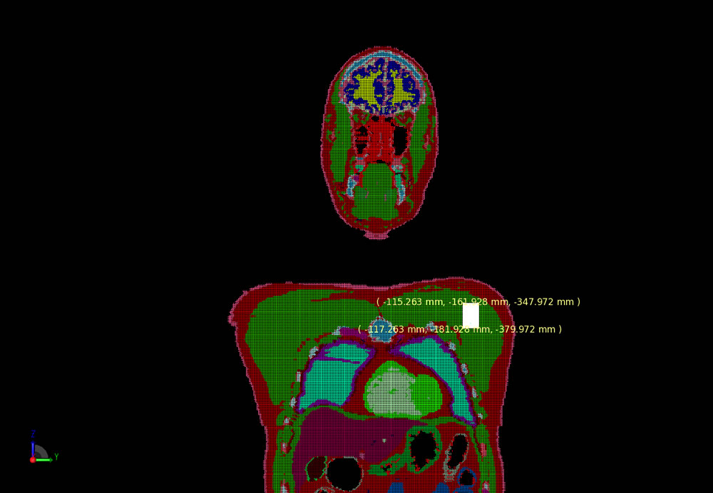 Abbildung 5: Netz der Patch-Antenne im Körper.
